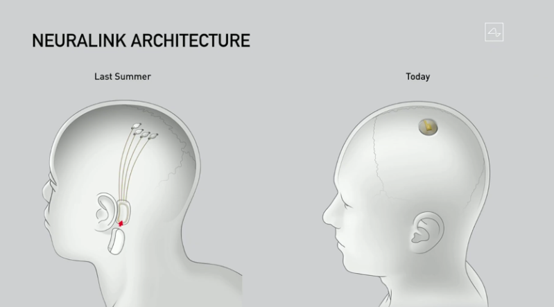 Neuralink