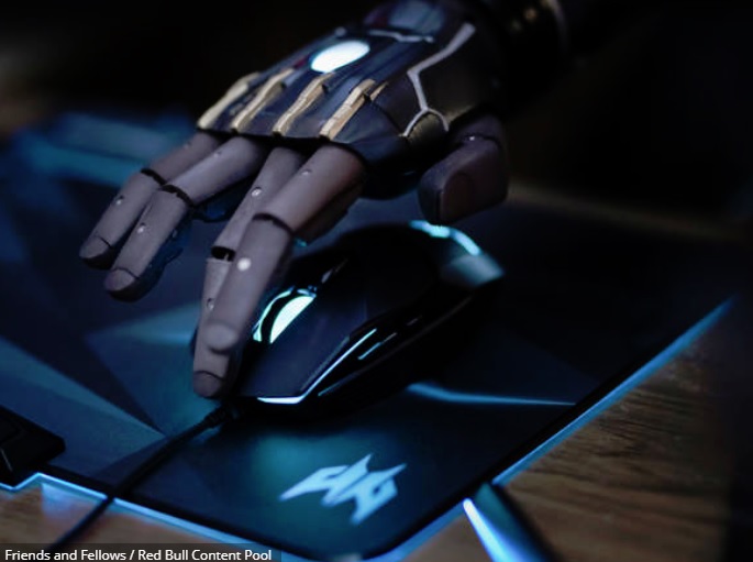 One day, Danielle Melville hopes he can get fine motor control with his fingers using an artificial limb.