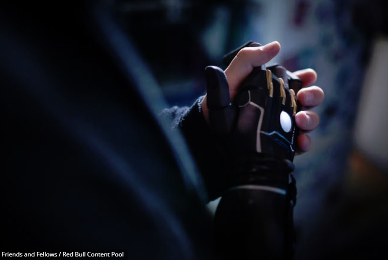 Danielle Melville is hopeful about how bionic limbs can help people with disabilities.