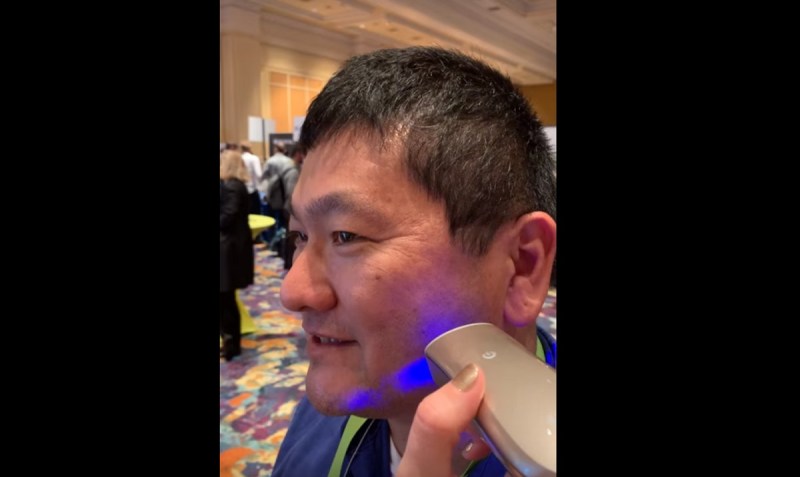 Dean Takahashi gets the Opte treatment.