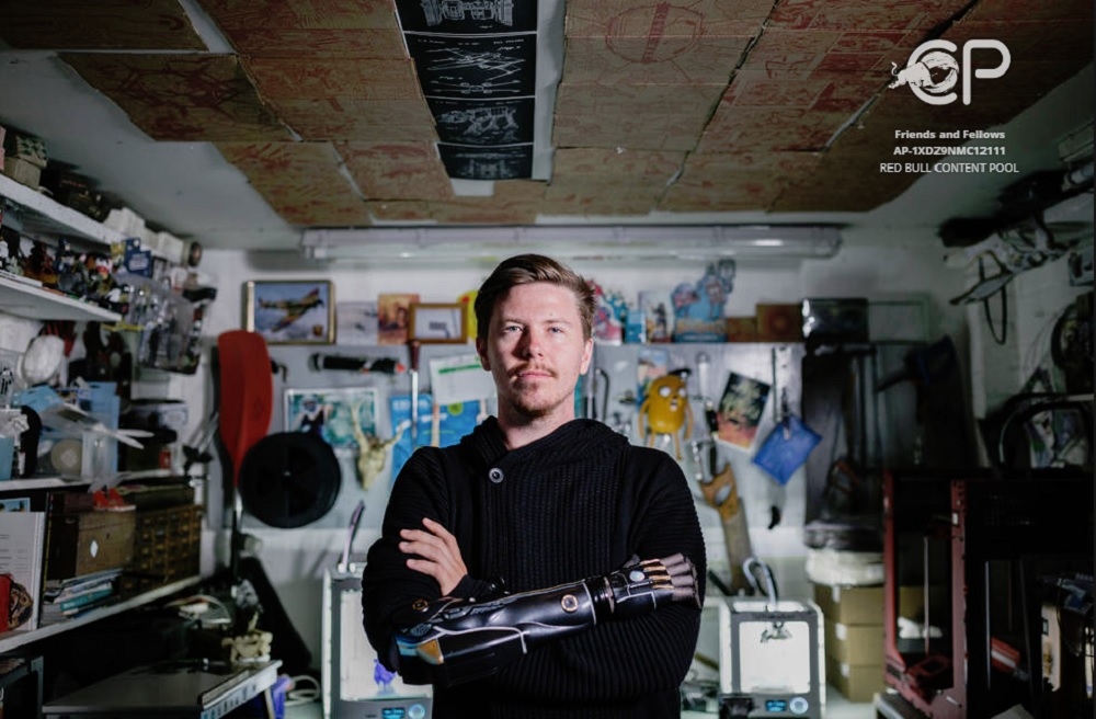 Daniel Melville has a 3D printed arm from Open Bionics. It is based on the arm of character Adam Jensen in the video game Deux Ex: Mankind Divided.