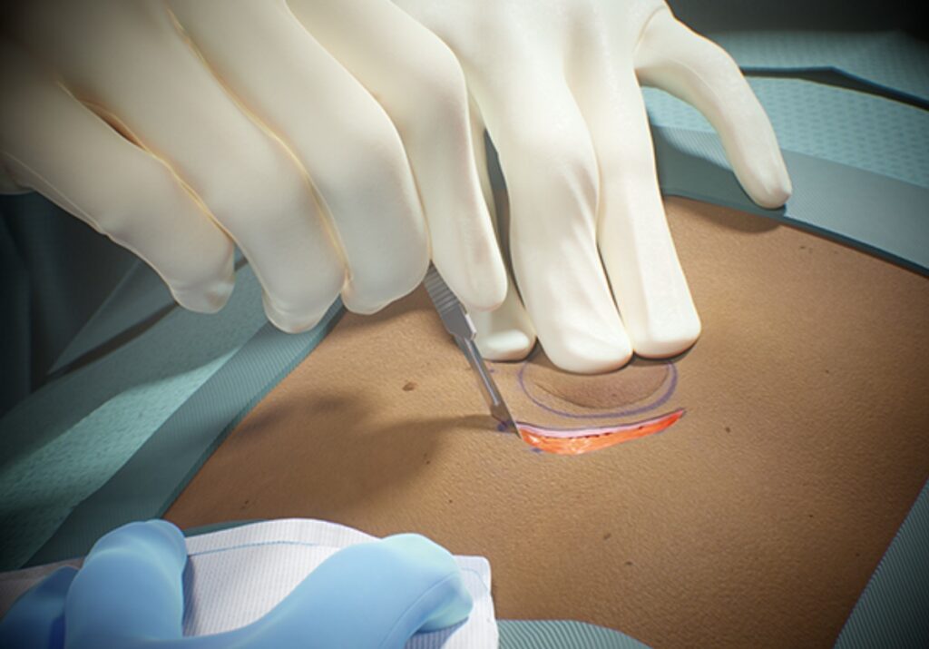 Fundamental VR is enabling virtual surgery with haptic feedback.